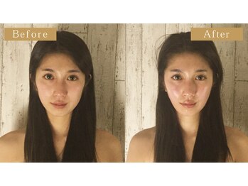 頭蓋骨 小顔矯正サロン グレースフィオーレ 札幌店(gracefiore)/ビフォーアフター