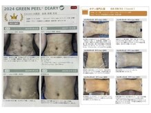 ココティー 大阪店(Cocotii)