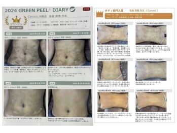 ココティー 大阪店(Cocotii)