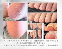 ケアプラス(care plus)