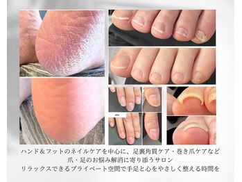 ケアプラス(care plus)