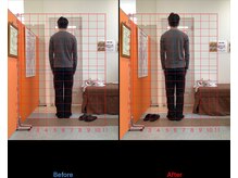 ゼロヒャク整骨院(ZERO100整骨院)/猫背矯正×骨盤矯正