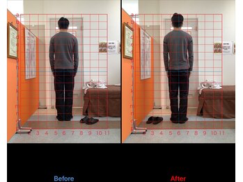 ゼロヒャク整骨院(ZERO100整骨院)/猫背矯正×骨盤矯正