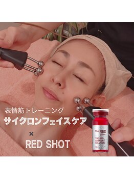 ホープ(Hope)の写真/【タルミが気になる方へ】最強小顔タッグ！REDSHOT×サイクロンでタルミ知らずのシャープな輪郭へ
