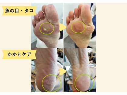 フレッシュフット(FreshFoot)の写真