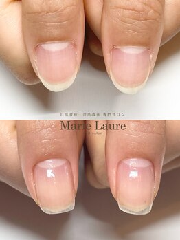 マリーロール 梅田店(Marie Laure)/自爪育成/深爪矯正/ネイルケア