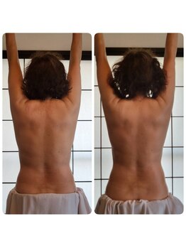 縁 エン/超人気！バックトリートメント☆