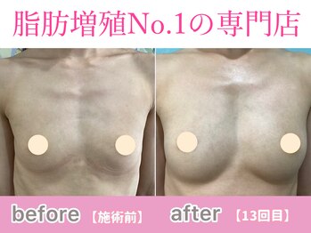 サラエクセレント 天王寺(SARA EXCELLENT)/デコルテからバストアップ!