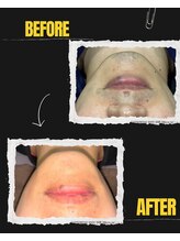 デサフィオ(Desafio.sln)/髭