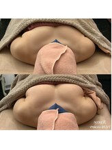 ルミエール(Lumiere)/【倉敷市】バストアップ施術事例