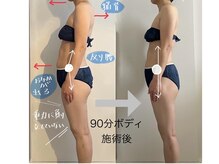 コンテ(Conte)/ボディ施術の変化