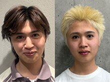 エムケー(M.K.)/浮腫解消　小顔矯正1回目→3回目