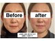 グリーン鍼灸整体院(green鍼灸整体院)の写真/３０代～５０代のその顔の【たるみ・むくみ・顔のデカさ】は年齢のせいじゃない！やらな何もかわらんよ！