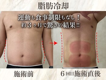 ウィボーテ(We Beaute)の写真/【痩身専門サロン】理想の体型で自信を手に入れたい!脂肪冷却、脂肪分解で気になる部分へ徹底アプローチ!