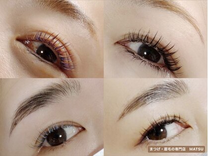 マツ(MATSU)の写真