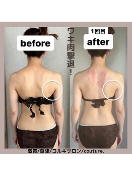 クチュール(couture.)/お背中の施術