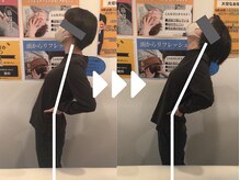 ミライズ整体院 三宮本院/事例【30代女性・腰痛】