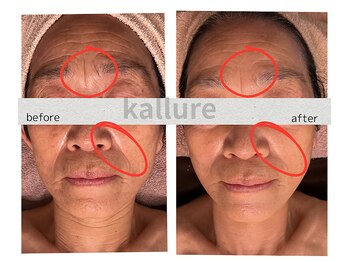 カリュール(K'allure)