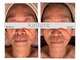 カリュール(K'allure)の写真