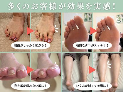 ピースの写真
