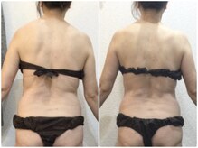 ウェリナ平和堂長久手院/小顔矯正/骨盤矯正/美脚サロン