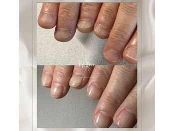 フィグ ツリー(fig tree)