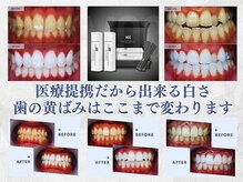 ブルーミン 我孫子(Bloomin‘)