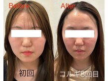 ビーキュート 学芸大学店(BE-CUTE)/Before/After　施術