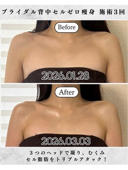 シーフェイス 横浜店(SEE FACE)/横浜駅近ブライダル痩身エステ