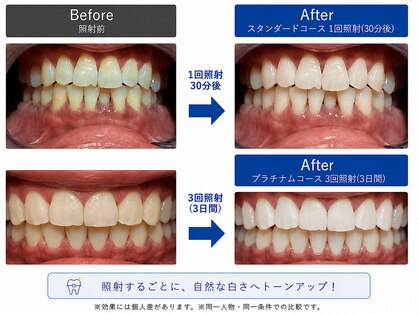 フルーリラ(fleulilas)の写真