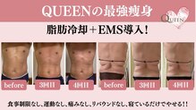クイーン(QUEEN)