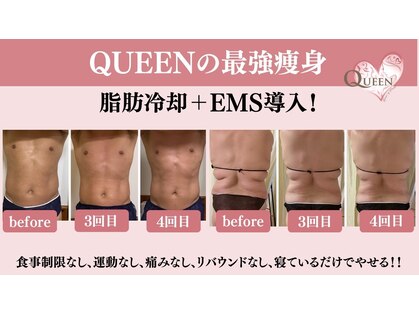 クイーン(QUEEN)の写真