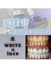 ホワイト ルシェ(WHITE×luce)/歯のイメージ印象は変わります