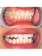 ライトビューティー 池袋店(LightBeauty)/症例写真