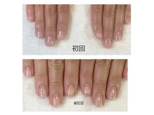 ナオ(nao)の雰囲気（自爪育成）