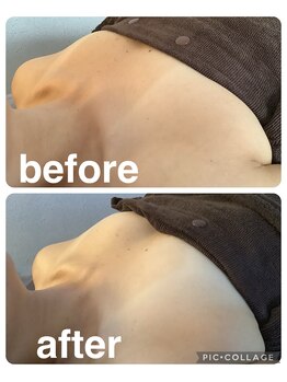 ギンザアール(GINZA R.)/理想のふっくらバストに♪