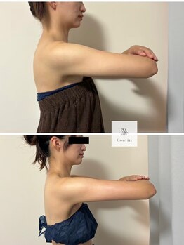 エムクリニカルラボ 藤沢(M clinical lab)/脂肪燃焼剤導入×痩身エステ