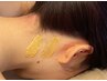 【うなじ脱毛MIX脱毛】¥10000→¥9000
