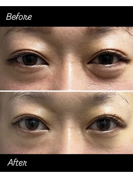 ガーデン(Garden)/小顔矯正＆美容小顔カッサ