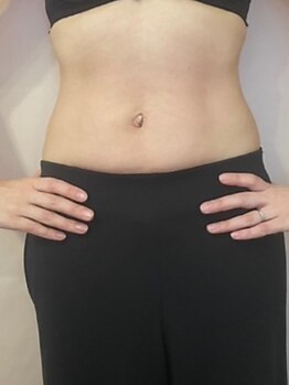 ゆうの写真/くびれは鍛えるより、整える。巡りと内側からつくる立体ライン