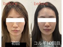 ビーキュート 姫路店(BE-CUTE)/小顔コルギ10回目