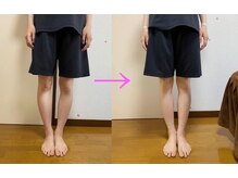 美容整体サロン オオカンシャ(okansha)/O脚改善