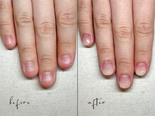 ユユネイル(yuyu nail)/深爪育成 自爪風仕上げ