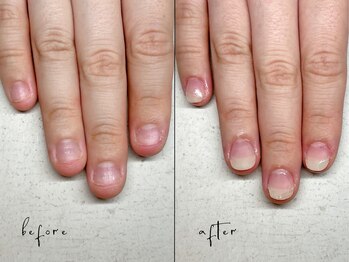 ユユネイル(yuyu nail)/深爪育成 自爪風仕上げ