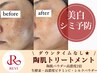 【美白・シミ予防】ハーブピーリング＋贅沢オプション３種¥ 21,900