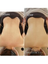 アロンドール リム(alondor rem)/before/after &nbsp;@生体電流ケア