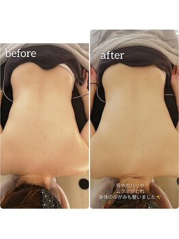 アロンドール リム(alondor rem)/before/after @生体電流ケア