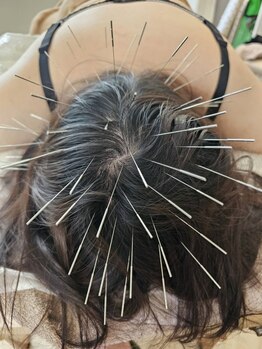 眼精疲労を解消したい