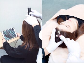 ジタ整体院の写真/ヒト由来成分配合の美容液と最新機器で負担なく頭皮を健やかに。一人ひとりに合わせた育毛促進ケアをご提案