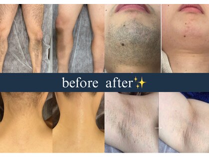 脱毛専門サロン エリクサー(Elixir)の写真